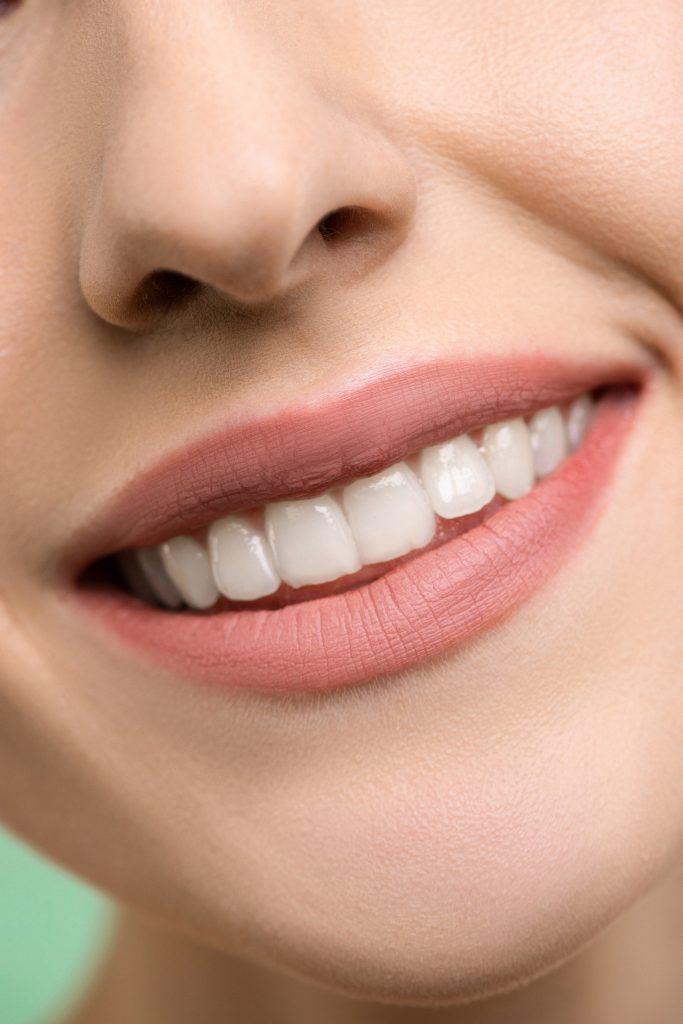 Teeth Whitening Groupon